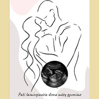 Personalizuotas nėščiųjų echoskopijos tyrimo spaudinys ant drobės, su jūsų nuotrauką ir linijine iliustracija  Drobe -  dovanokis.lt